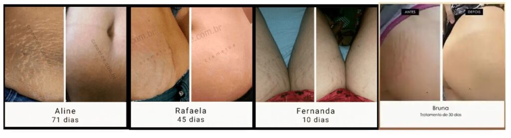 creme toe ante e depois